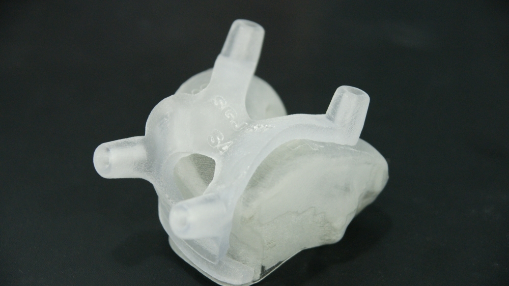 3D프린터로 재현한 환자의 무릎관절과 인공관절 수술도구. (사진=연세사랑병원 제공)