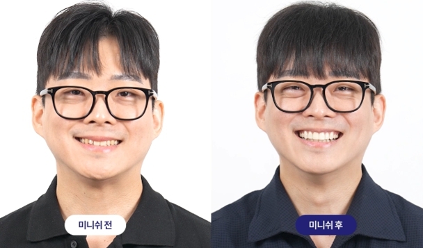 (사진=이승희디지털치과 제공)
