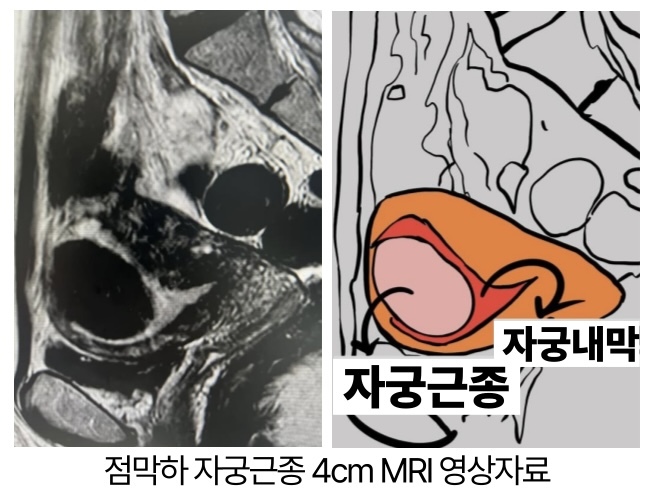 (사진=서울하이케어의원 제공)