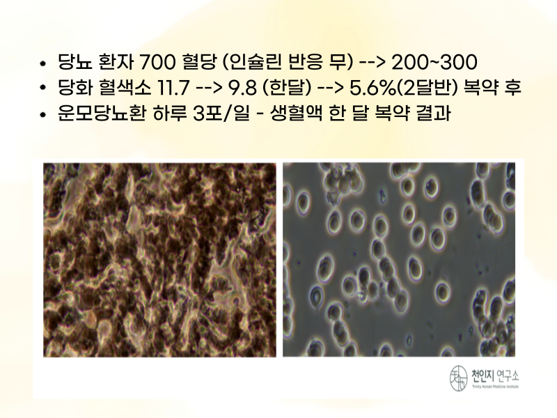 인슐린 주사에 반응하지 않던 당뇨 환자가 ‘운모당뇨환’을 하루 3포씩 복약한 후 한 달 뒤 관찰된 생혈액 변화. 당화혈색소 수치도 11.7%에서 5.6%로 개선됐다. (사진=천인지한의원 제공)