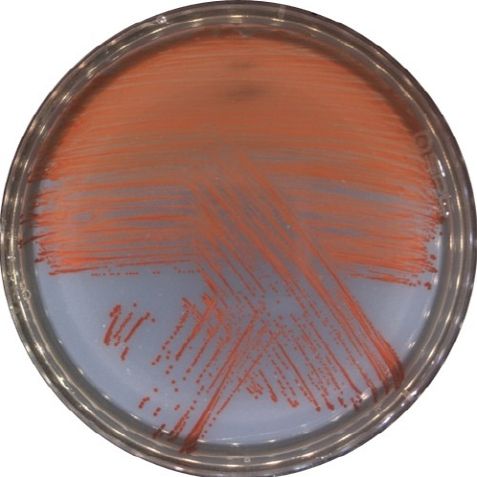 신종 비브리오 VRS2 균주를 배양한 사진(적색의 프로디지오신을 생성함)